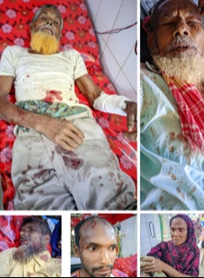 ধামইরহাটে জমি জমা সংক্রান্ত বিরোধে নিহত ১, আহত ৭