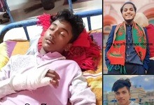 পটুয়াখালীতে শিক্ষার্থীর আঙ্গুল ভাংগলো কিশোর গ্যাং