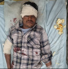 সাপাহারে মারপিটের ঘটনায় ৩ জন আহত