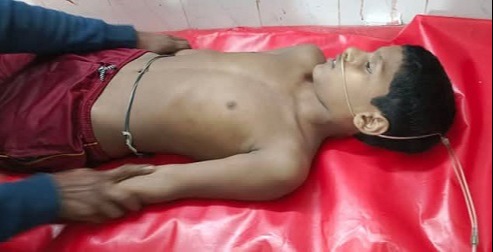 দিঘলিয়ায় বিদ্যুৎ স্পৃষ্ট হয়ে শিশুর মৃত্যু