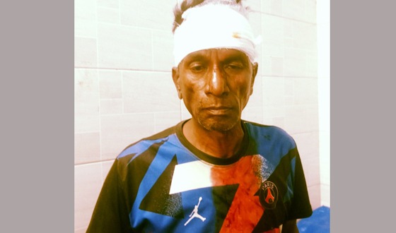 সাপাহারে মোটর শ্রমিক নেতা মোজাফফর কে পিটিয়ে আহত