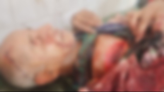 কালীগঞ্জে জমি সংক্রান্ত বিরোধে ৩ জনকে কুপিয়ে হত্যা চেষ্টা