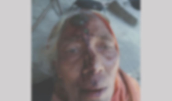 পাইকগাছায় জমি দখলে কেন্দ্র করে আহত ৬