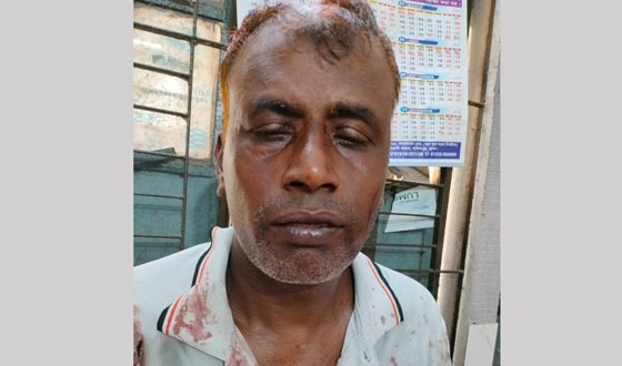 দিঘলিয়ায় ছোট ভাইয়ের রামদায়ের কোপে সাবেক সেনা সদস্য জখম