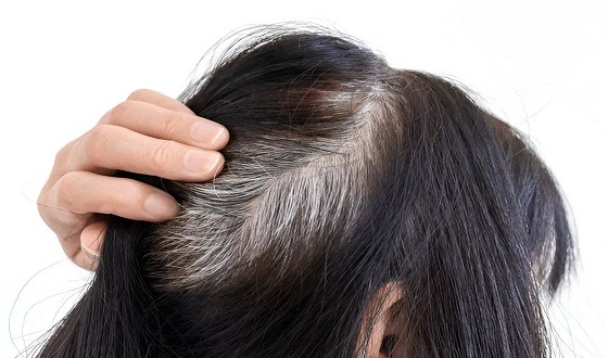 অকালে চুল পাকা আটকাতে মেনে চলুন সহজ কিছু অভ্যাস