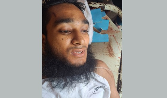 গফরগাঁওয়ে ট্রেনে উঠতে গিয়ে যুবকের পা বিচ্ছিন্ন