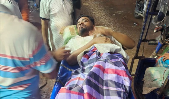 নোয়াখালীতে যুবদল কর্মির গুলিতে জামায়াতের ২-কর্মী গুলিবিদ্ধ