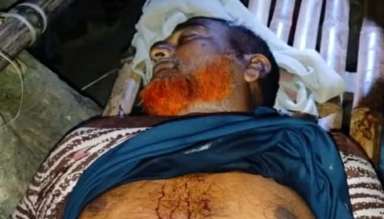 দৌলতপুরে দুর্বৃত্তদের ছোড়া গুলিতে বিএনপি কর্মী নিহত