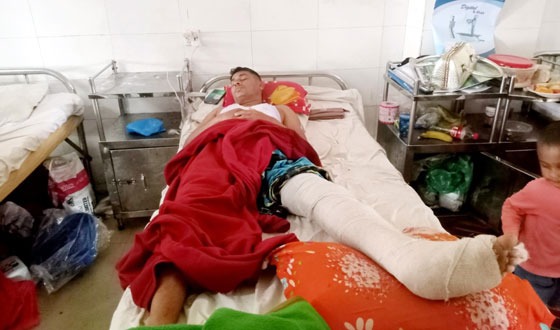 প্রতিপক্ষের হাতুড়ি পেটায় শ্রমিক দল নেতা আহত