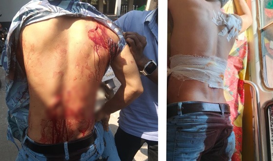 লালমোহনে পাওনা টাকা চাওয়াকে কেন্দ্র করে হামলায় আহত ৬