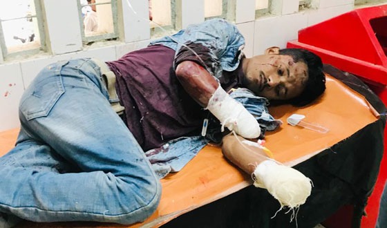 সাঁথিয়ায় ৯ মামলার আসামির দুই হাতের কব্জি বিচ্ছিন্ন