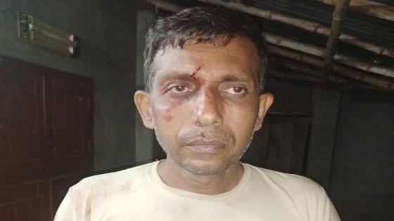 বাগমারায় সেনাকর্মকর্তাকে কুপিয়ে জখম করার অভিযোগ