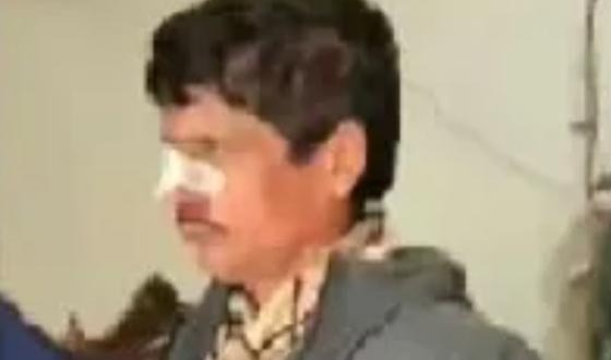 মাদারীপুরে মানবপাচারকারীকে গণপিটুনি দিয়ে পুলিশে সোপর্দ