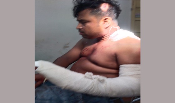 সন্ত্রাসী হামলায় যুবদল নেতার হাতের কব্জি বিচ্ছিন্ন