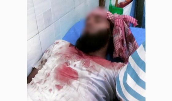 সাপাহারে জমি জমা সংক্রান্ত বিরোধে সংঘর্ষ, আহত ৪