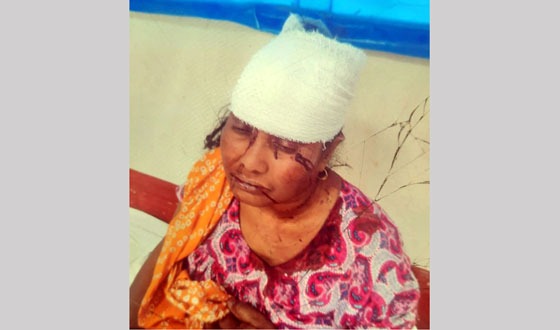 বিরলে জমি-জমার বিরোধ নিয়ে মারধোর, আহত ২