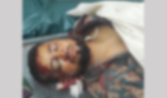 বেনাপোলে মোটরসাইকেল নিয়ন্ত্রণ হারিয়ে বিজিবি সদস্য নিহত