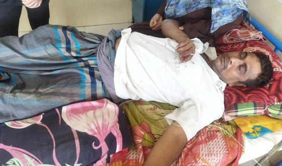 পূর্বাশা পরিবহনের কাউন্টার মাস্টারকে কুপিয়ে ও পিটিয়ে আহত