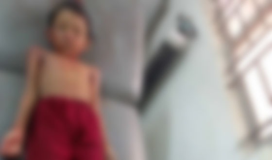 তালতলীতে অটোরিকশার চাপায় শিশু নিহত