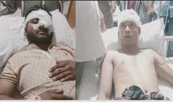 মহেশপুর বিএনপি নেতাকর্মীদের উপর আ’লীগের হামলা, আহত ২০