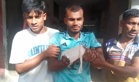 বাঘায় বোমা তৈরী করতে গিয়ে কলেজ ছাত্রের হাতের কবজি বিচ্ছিন্ন