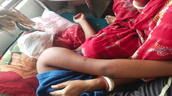 তানোরে সাংবাদিকের বাড়িতে চোরাগুপ্তা হামলা, মা ও ভাগ্নেকে কুপিয়ে জখম