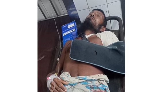 ডুমুরিয়ায় ছোট ভাইয়ের দা'র কোপে বড় ভাই জখম