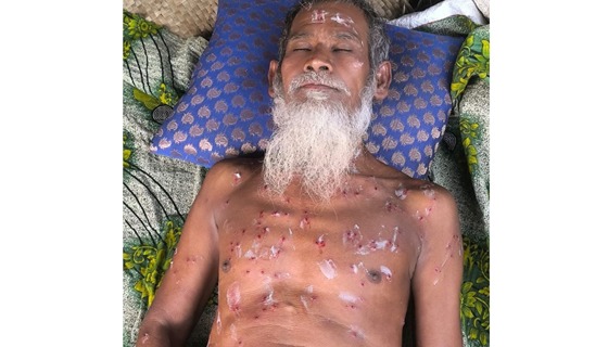 পাংশায় পুলিশের অভিযানে বৃদ্ধ গুলিবিদ্ধ