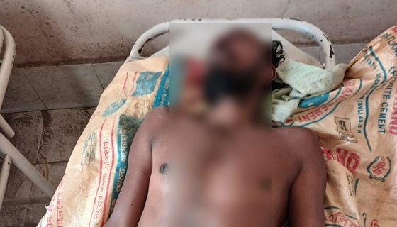 পিরোজপুরে গণপিটুনিতে ডাকাত নিহত