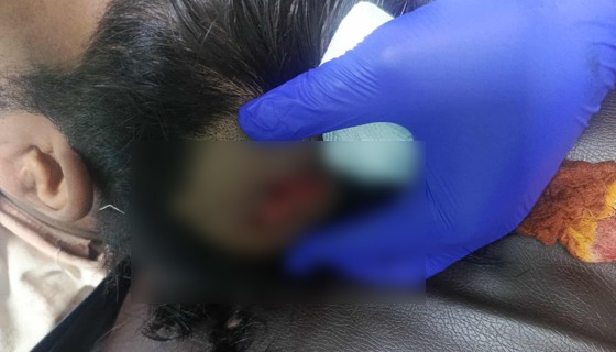 শ্রীনগরে প্রতিবেশীর আঘাতে যুবক মৃত্যু শয্যায়