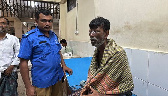 চাঁদপুরে ঘুমন্ত স্বামীকে এসিড দিয়ে ঝলসে দিলেন স্ত্রী