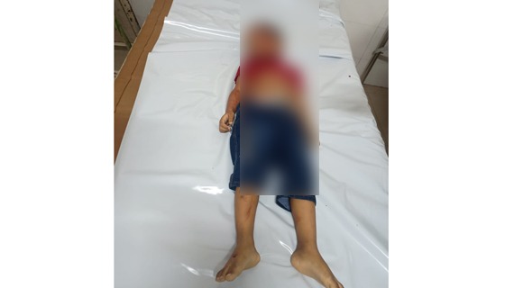 বাবুগঞ্জের সড়ক দুর্ঘটনায় শিশুর মৃত্যু, গুরুত আহত মা