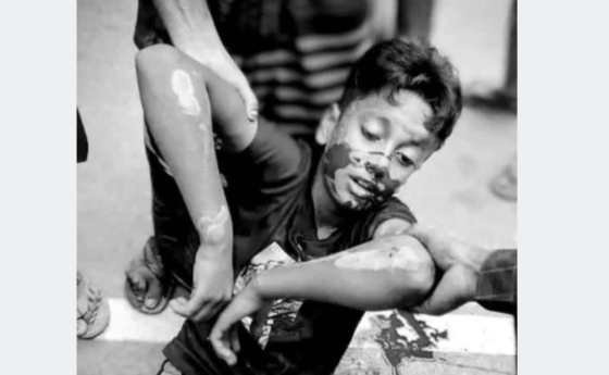 ভূরুঙ্গামারীতে সড়ক দূর্ঘটনায় শিশুর  মৃত্যু