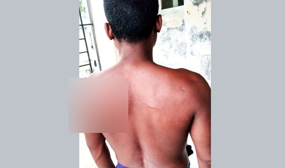 তানোরে পূর্বশক্রুতার জেরে যুবককে কুপিয়ে হত্যার চেষ্টা