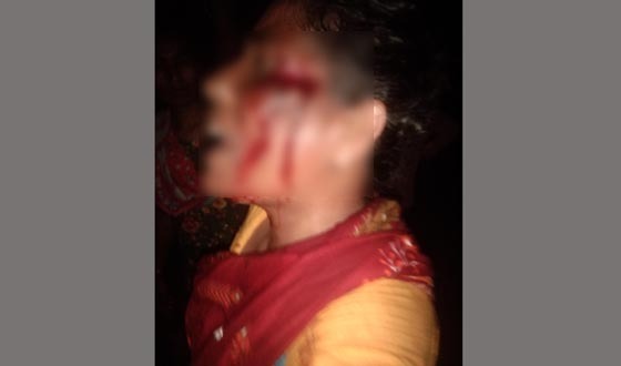 জমিতে পানি সেচ দেওয়াকে কেন্দ্র করে বিএনপি নেত্রীকে কুপিয়ে জখম