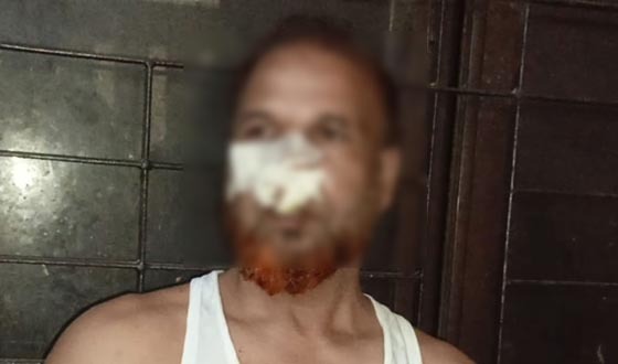 বাজিতপুর হাটে চোর সন্দেহে গণধোলাই