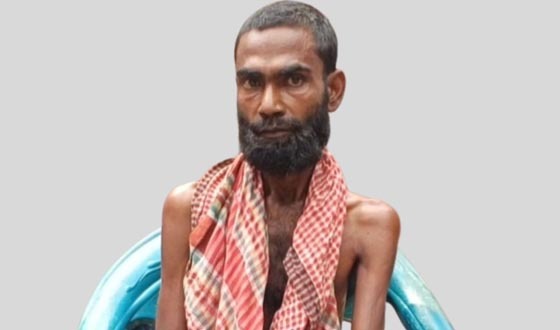 ৫ লাখ টাকার দেয়ালে থমকে থাকা জীবন, জুয়েলের নিঃশব্দ আর্তনাদ