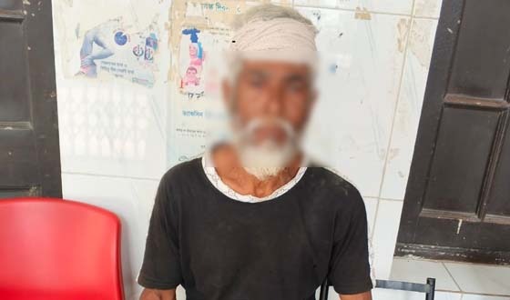 বিরলে জমি-জমার বিরোধে দুপক্ষে মারপিট