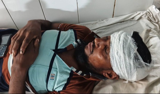 সাপাহারে তুচ্ছ ঘটনায় দম্পতিকে পিটিয়ে জখম
