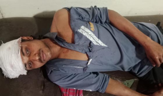 আশাশুনিতে জমি ছাড়তে বলায় শাবলের আঘাতে রক্তাক্ত জখম