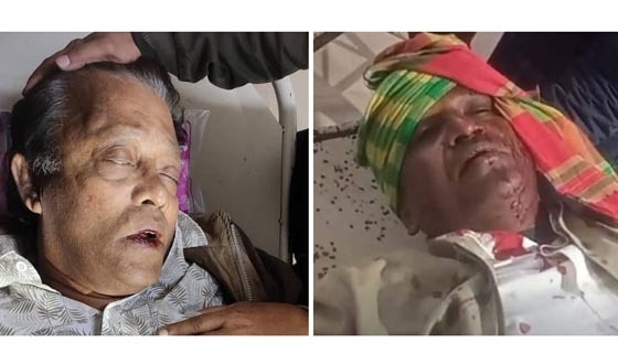 পিরোজপুরে দুর্বৃত্তের হামলায় বিএনপির ২ নেতা আহত