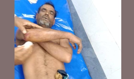 শৈলকুপায় আধিপত্য বিস্তারকে কেন্দ্র করে সংর্ঘষ, পুলিশসহ আহত ৭