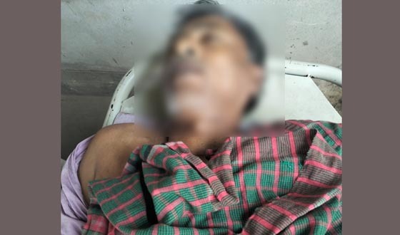 শৈলকুপায় পারিবারিক বিরোধে মারপিট, নিহত ১