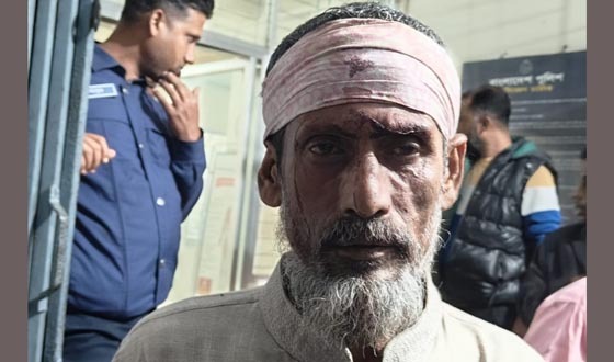 আ.লীগ সন্ত্রাসীদের হামলায় মৎস্যজীবী দলের নেতাকে কুপিয়ে জখম, আহত ৫