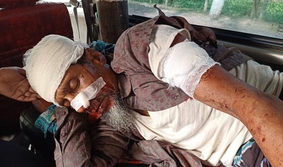 কচুয়ায় বৃদ্ধের ওপর হামলা, আশঙ্কাজনক অবস্থা
