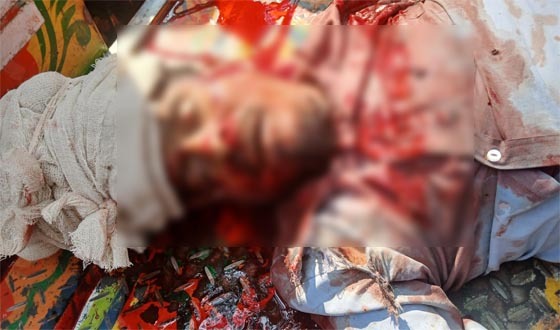 সাঁথিয়ায় অটোবাইকের চাকা খুলে নিয়ন্ত্রণ হারিয়ে প্রাণ গেল চালকের