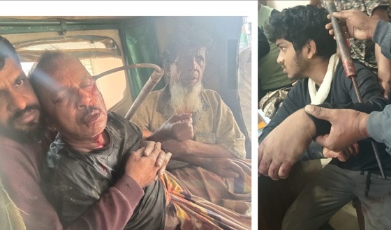 কটিয়াদীতে সম্পত্তি নিয়ে ভাইয়ের সাথে বিরোধ, টেটা বিদ্ধ পিতা পুত্র