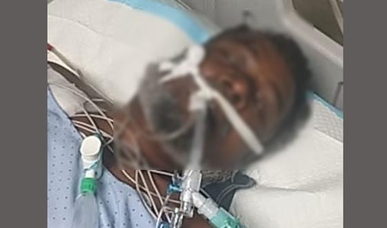 কলাপাড়ায় সড়ক দূর্ঘটনায় ছেলের পর বাবার মৃত্যু