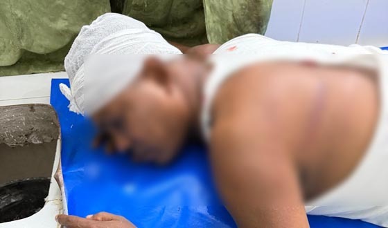বরিশালে সাবেক কাউন্সিলরকে পিটিয়ে গুরুত্বর জখম
