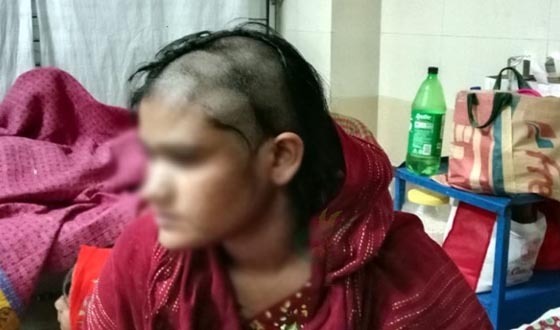 ঝিনাইদহে গৃহবধূর উপর নির্যাতন, মাথার চুল কেটে ফেলার অভিযোগ